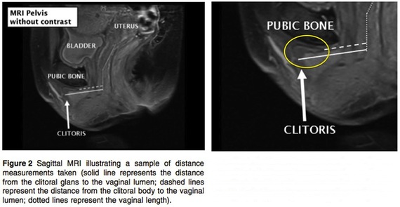 Clit small 5 Facts