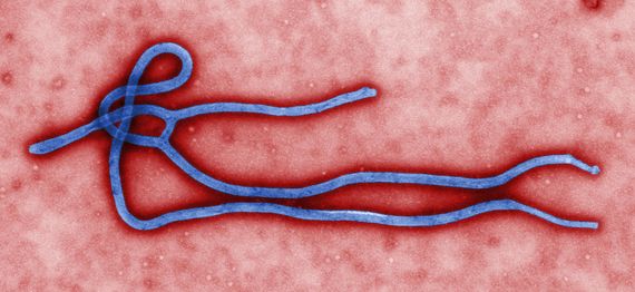 2014-11-18-Ebola_virus_virion.jpg