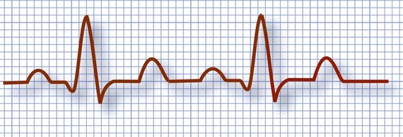 2014-11-26-EKG.jpg