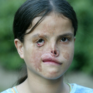 2014-12-12-VorherMawigul.jpg