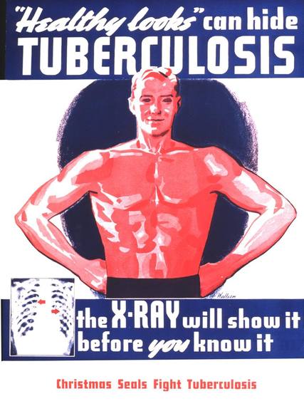 2015-02-06-Tuberculosis2.jpg