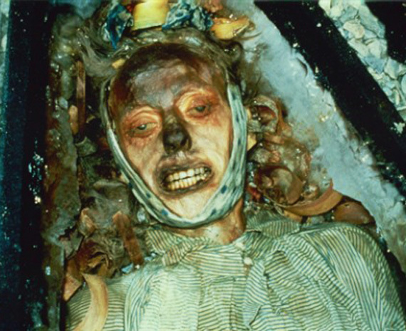 embalmed body after 10 years