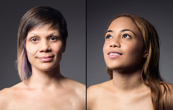 4 Women Show The Reality Of Their Mastectomies In Stunning Photos 6286