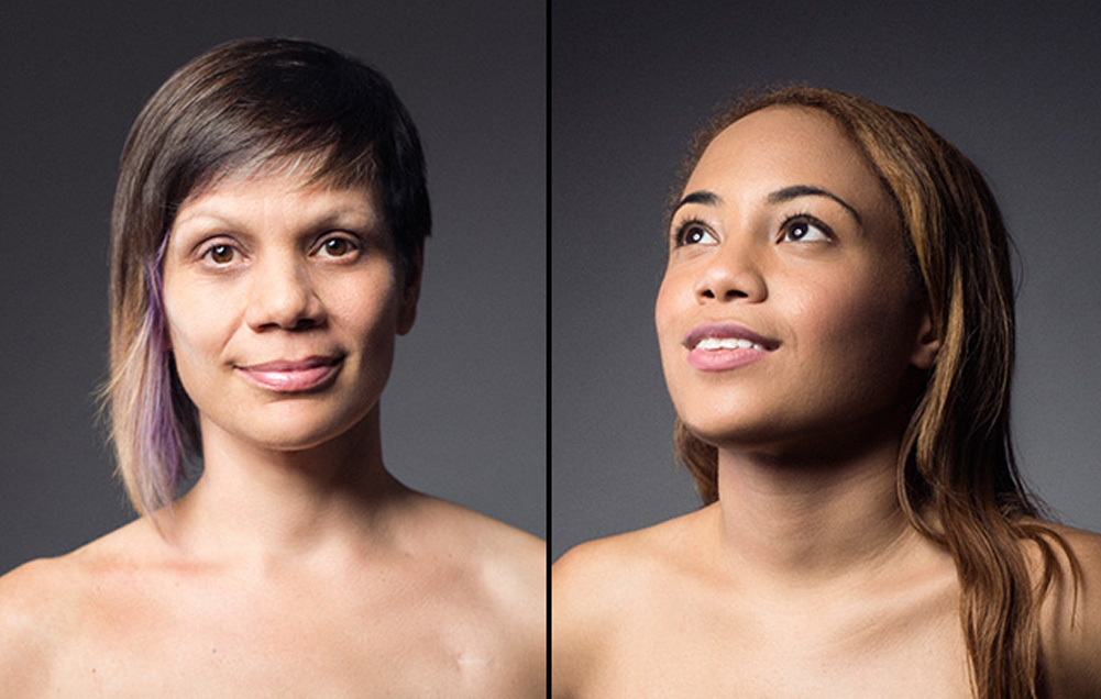 4 Women Show the Reality of Their Mastectomies in Stunning Photos ...