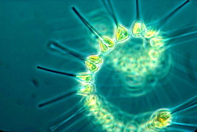 2015-11-10-1447179350-2247869-planktonphytocreditNOAAMESAproject640pxPhytoplanktonfoundationofoceanicfoodchaina.jpg