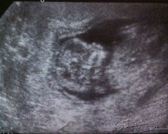 2015-12-14-1450128503-9819153-pregnancy_sonogram_SamanthaGWrites.Com.jpg