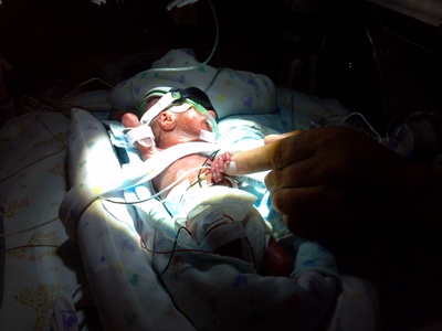 premature baby in incubator micropreemie