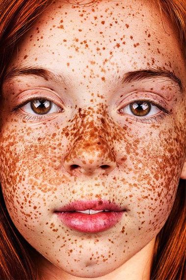 Breathtaking Photos Show The Undeniable Beauty Of Freckles Huffpost