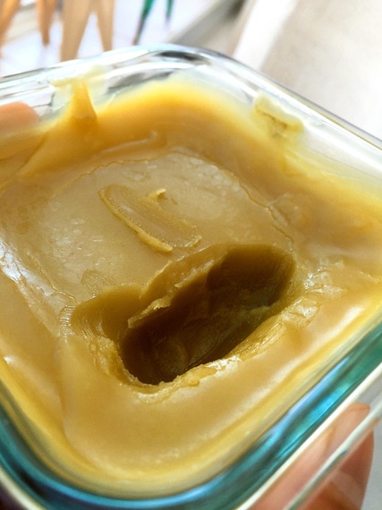 9 Reasons Why Topical Steroid Withdrawal Is Awesome