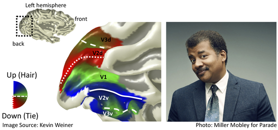 2016-05-13-1463110037-9115638-WeinerBrainMaps_TysonImage.jpg