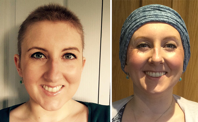 Embracing Chemo Induced Hair Loss The Warrior Within