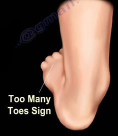 2016-08-24-1472069739-5819894-ankle11.PNG