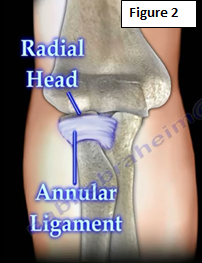Pulled Elbow in Children, Nursemaid's Elbow | HuffPost Life