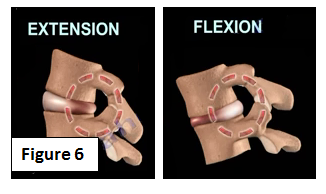 Body Positions Affecting The Spine | HuffPost Life