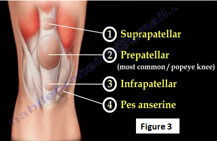 2016-09-20-1474394731-7361642-knee3.PNG