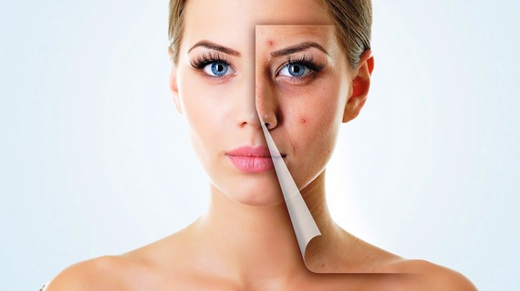 2016-09-27-1474961534-6647979-clearskin.jpg