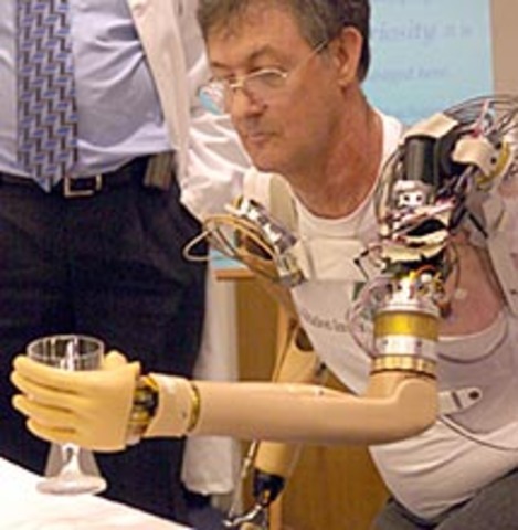 2016-12-12-1481522531-3696926-0624_JesseSullivanUsingBionicArm.jpg